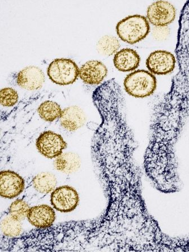 O que se sabe sobre a síndrome pulmonar por hantavírus